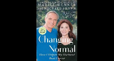 Changing Normal