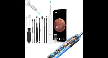 Oor Reiniger - Otoscoop Camera - Oor Inspectie - HD IPS Scherm - Wit