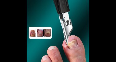 3 items Geschikt voor dikke en ingegroeide nagels: een uiterst precieze nagelknipper van robuust roestvrij staal, Geschikt voorzien van een veilige, zachte handgreep en een vlijmscherp mes met een hoek van 25 graden, speciaal ontworpen zwart.